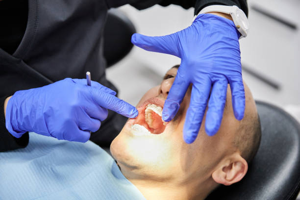 Best Emergency Dental Care for Broken or Chipped Teeth in Beattystown, NJ
